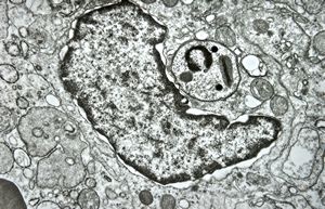 M,28y. | Leishmania - skin M,28y. | Leishmania - skin